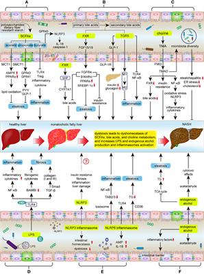 The Role of the Intestinal Microbiota in Nonalcoholic Steatohepatitis